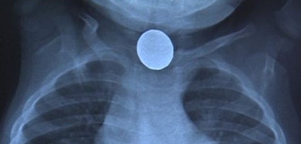 119b723b16c8db58aec4ce98d4a2d864