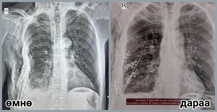 08A1AB41-EF72-C06D-25C6-C636DAEE516F