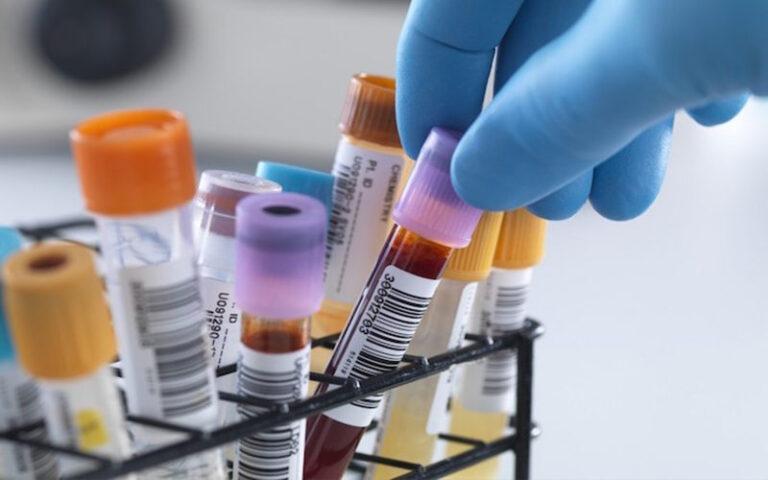 uRWnYA0nqAgKBJhBHdwc